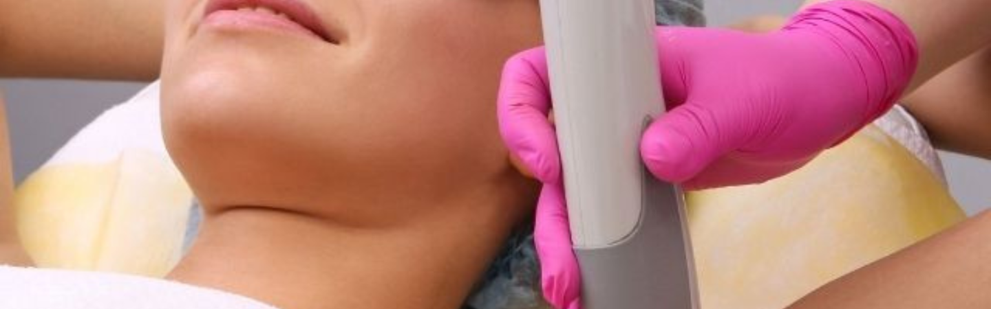 Laser Resurfacing